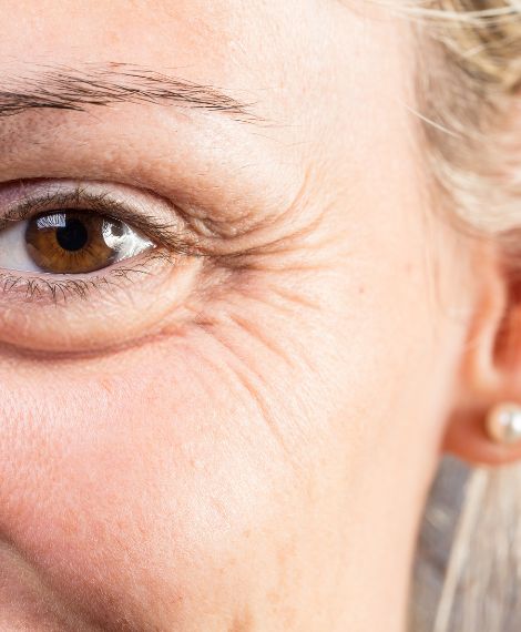 Doctor performing botox treatment at Alysia Clinic